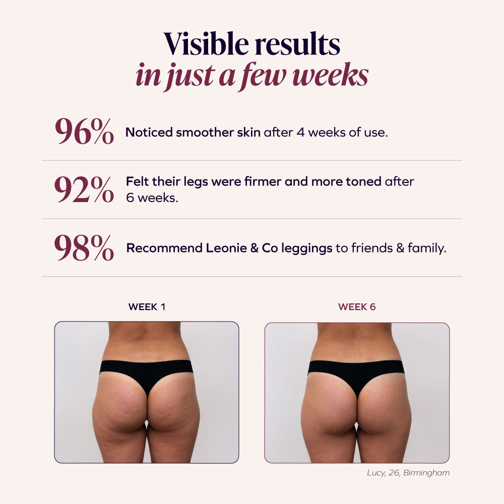 3D Anti-Cellulite Leggings