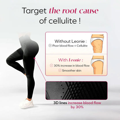 Leggings that target the root cause of cellulite