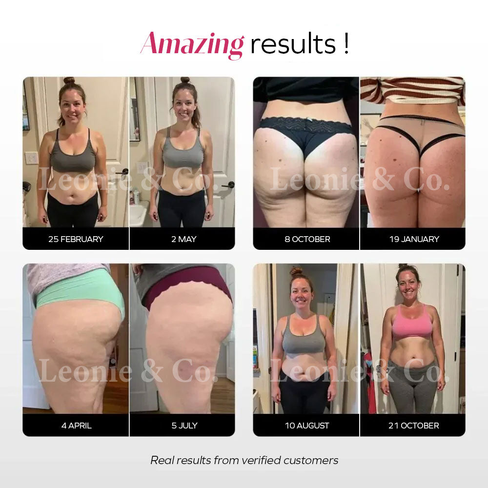 Incredible results with Leonie’s anti-cellulite leggings