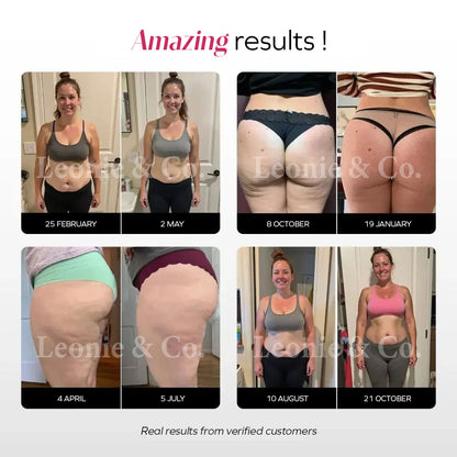 Incredible results with Leonie’s anti-cellulite leggings